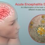 Japanese Encephalitis in Assam: Understanding the Rising Trends and Risks